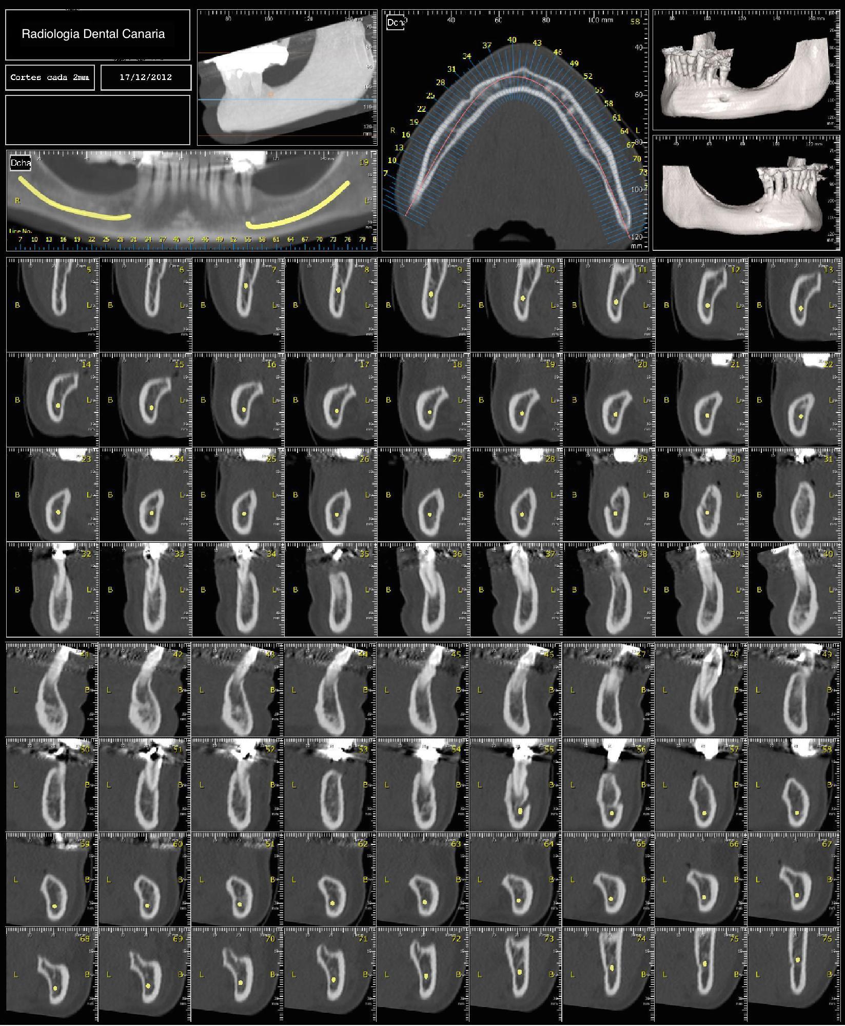 Escáner CBCT