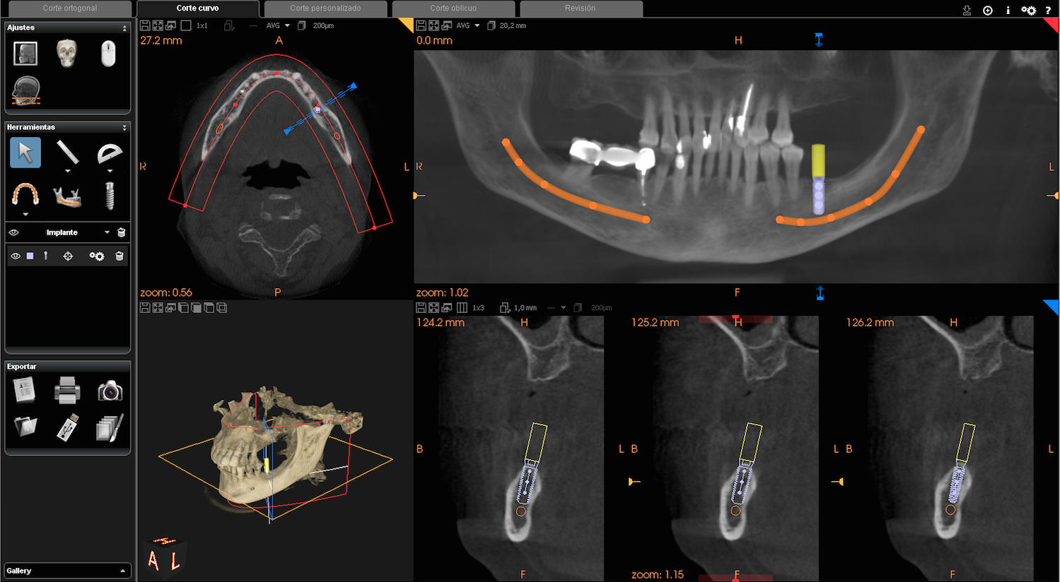 Radiología Dental Canaria