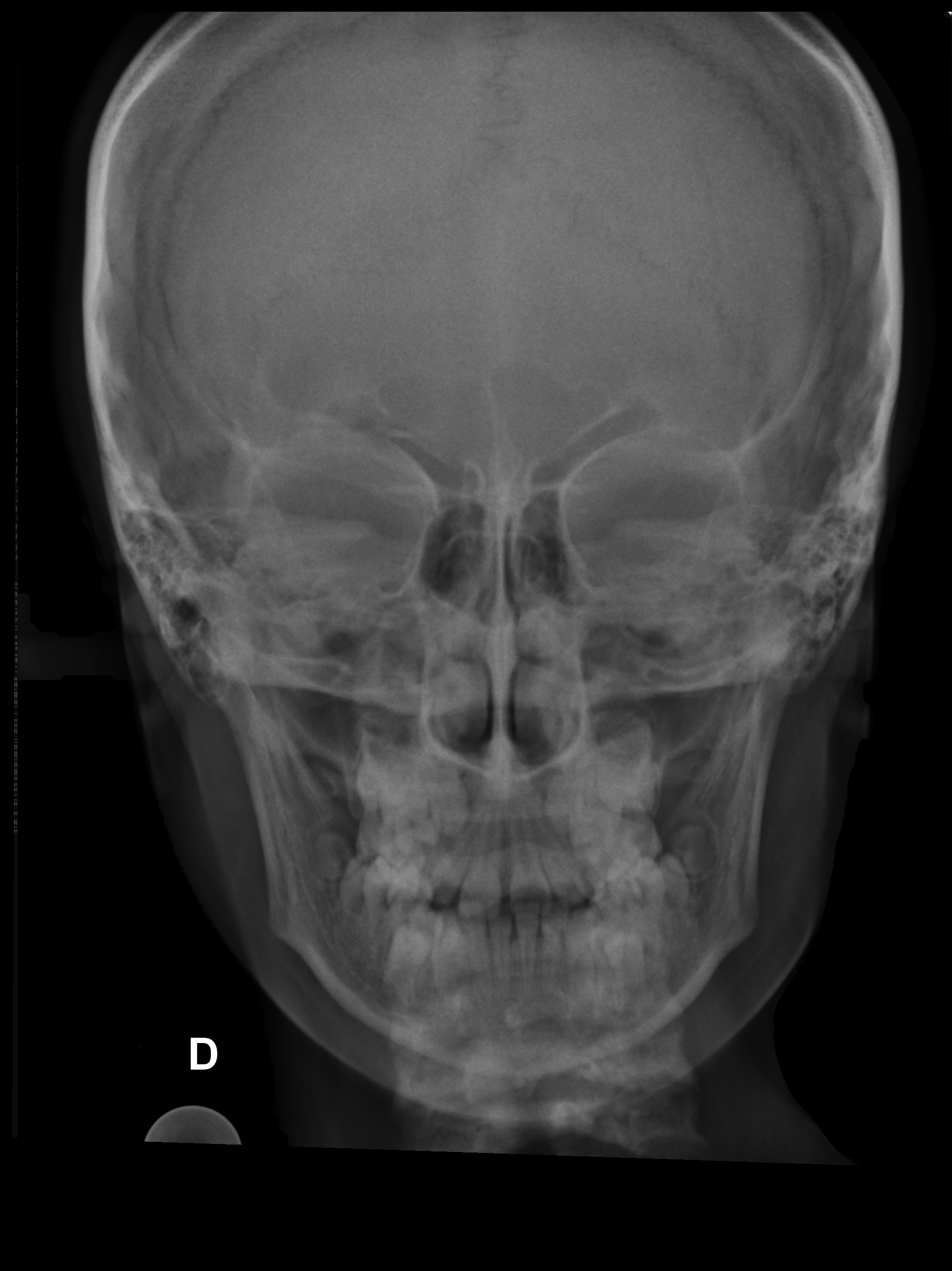 Radiografía frontal